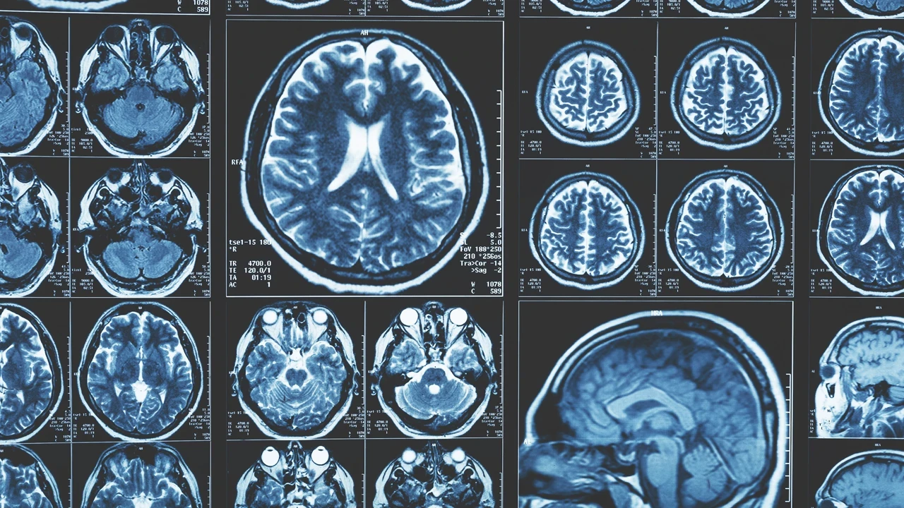 Alzheimer için dikkat çeken bulgu: Her şey beyinle ilgili değil!