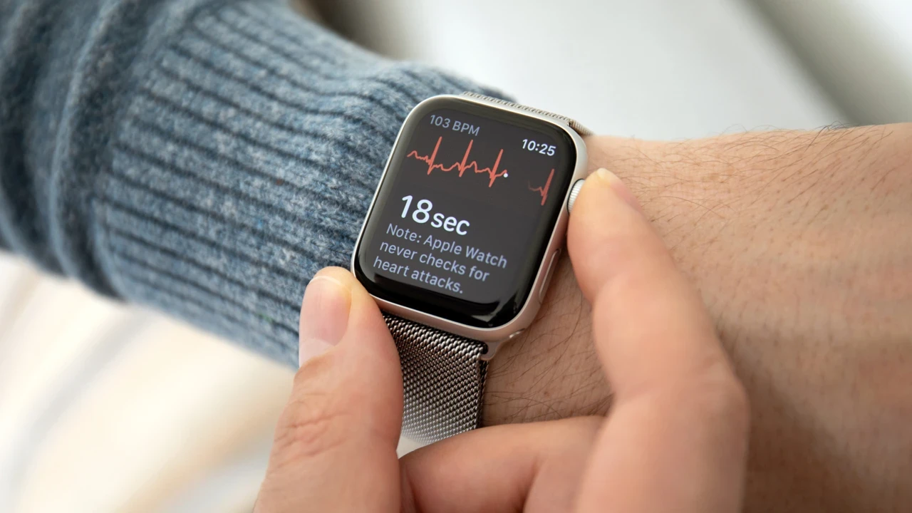 İkinci el, eski model bir Apple Watch mı alacaksınız? Bir daha düşünün!